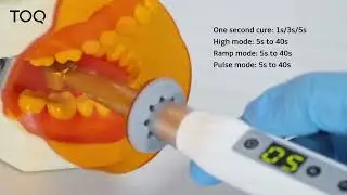 Topcure X