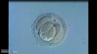 La f&eacute;condation chez l'Homme : 2 cellules haploides uniques fusionnent en une cellule-oeuf