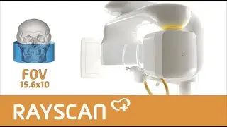 RAYSCAN m+