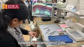 Master Periodontal & Peri-Implant Plastic Microsurgery &ndash; Elevate Your Skills! | IDEA Academy