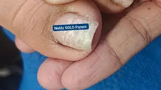 Pedicure January 28 #satisfying Neldz SOLO Parent  is live!