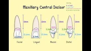 maxillary right central incisor Carving on wax