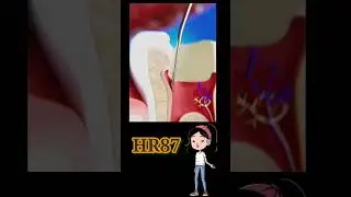 saat mata bor gigi patah#viralvideo #shorts
