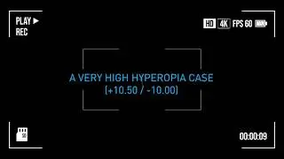 𝐄𝐘𝐄𝐂𝐑𝐘𝐋 𝐏𝐡𝐚𝐤𝐢𝐜 𝐂𝐡𝐚𝐥𝐥𝐞𝐧𝐠𝐢𝐧𝐠 𝐂𝐚𝐬𝐞𝐬 #astigmatism #myopia #hyperopia