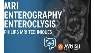 MRI Enterography & Enteroclysis | Philips MRI Techniques Explained |@Philips @avnishradiology 