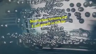 Non-lactose fermenting Escherichia coli growth on CLED Agar