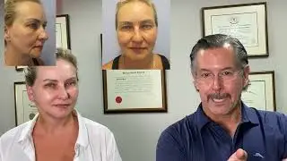 54 year old nurse just out from a short scar facelift with Dr. Lindsey, and interview.