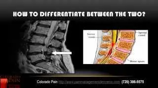 Is Your Hip Pain Caused by a Hip or Spine Problem?
