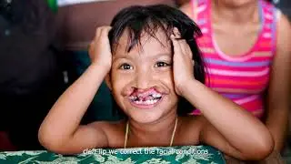 ABCs of Cleft Palate
