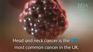 Supporting Mouth Cancer Action Month 2018