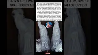 An X-ray reveals that the soft, developing bones of a 10-month-old can be harmed by wearing shoes