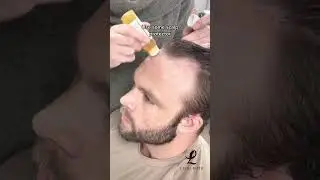 Full process of  installing frontal hairpiece
