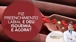 Fiz Preenchimento Labial e deu Isquemia, e agora?