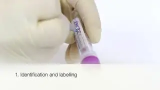 MiniCollect&reg; capillaire bloedafname