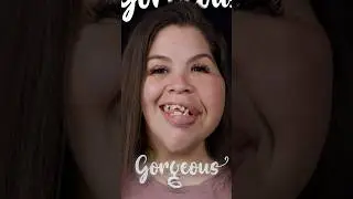 DENTAL IMPLANT MAKEOVER 🦷 | Smile Makeover #dentist #smiledental #dentalimplantsnearme #smile