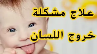 تمرين مهم جدا لكل اطفال متلازمة داون