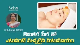 CHEMICAL PEEL TREATMENT PERFECTLY EXPLAINED BY DR B. DURGA KALYANI | KEHA SKIN & HAIR CLINIC