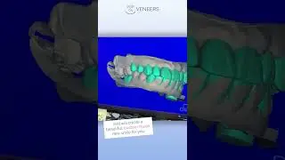 Getting Started With Pop On! 🤩👍 #shorts