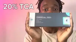 I Used a 20% TCA Chemical Peel from Platinum Skin Care | Light Application for Faster Peeling