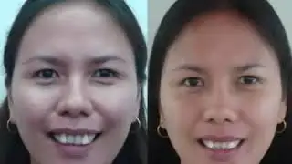 ageloc R2 Testimonial