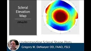 Using the sMap3D corneo-scleral topographer for fitting scleral lenses &ndash; Gregory W. DeNaeyer