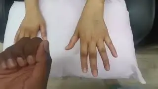 The Rheumatological examination (Hand examination osce. practical session)