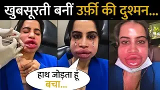 Urfi Javed's Painful Lip Filler Goes Wrong | Face Swollen After Botched Cosmetic Treatment