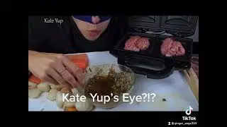 Kate Yup&rsquo;s eye?