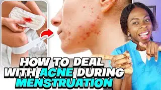 Causes of Acne during menstruation/ how to deal with acne during period