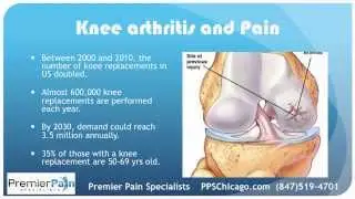 Knee Injection Options for Arthritis at Chicago pain centers (847) 519-4701