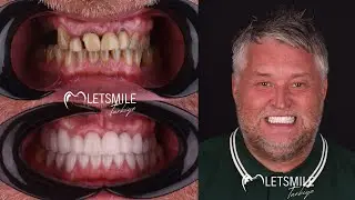 Dental Centre Antalya / Turkey  LETSMILE TURKIYE Best Smile Makeover | Turkey Dental Clinic