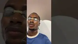 THIS IS YOUR SIGN TO GET LASER HAIR REMOVAL | Black Men