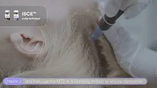[JJFilm] 리셀바이_제품시술가이드영상_ENG