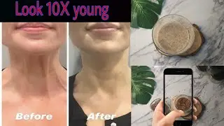 #antiaging #skintightening #finelines  How to look 10 years younger with BOTOX treatment at home