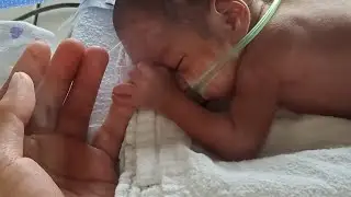 Our journey to NICU | Born @ 26 weeks | Mt. Sinai Hospital Toronto