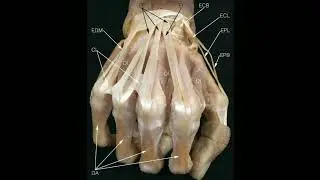 Tendons of forearm on back of hand#doctor #shortsfeed #short#viral#viralvideo #ankylosingspondylitis