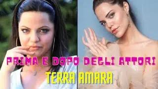 TERRA AMARA prima e dopo degli attori turchi