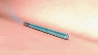 Intarcia MOA Animation