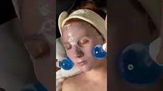 Ice Globe Facial Massage | BeautyFluff #shorts #shortsfeed
