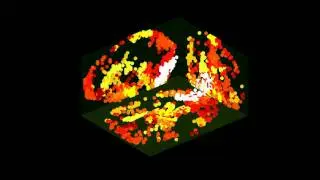 Intermezzo:  Brainmusic in fMRI time