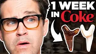 We Left Teeth In Coke For A Week (EXPERIMENT)