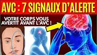 ⚠️ SOYEZ ATTENTIF À CE 7 SIGNES PRÉCOCES DE L’AVC - NE JAMAIS IGNORER !