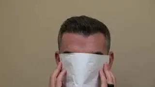 Best FUE Hair Transplant Doctor California at San Francisco SF Bay Area & San Jose Bald Hair Loss