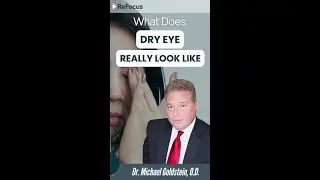 Understanding Dry Eye: Why Excessive Tears Can Indicate Underlying Issues &ndash; by East Hartford Eye Dr