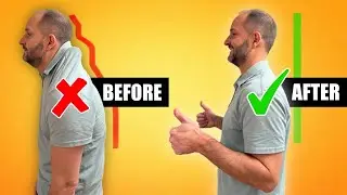 How to Fix Your Posture | Dr Matt Pennetti Centennial CO Chiropractor