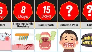(Timeline) What if you do not brush your teeth? || Data Vision (Comparison Video)