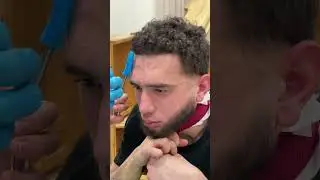 Кровопускание со лба снимают головную боль. У нас открыта обучение (8)(925)(571)(07)(77)