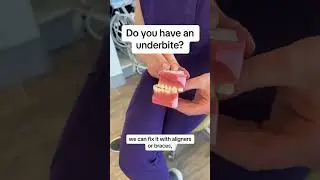 Underbite | How To Correct 😃