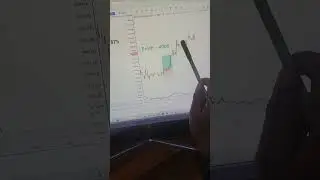 #niftytrading #nifty #stockmarket #trading #realtrader #optiontrading #stocks #youtube