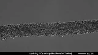 Supplementary Movie 6: Multicellular self-assembly of intestinal epithelial and stromal cells